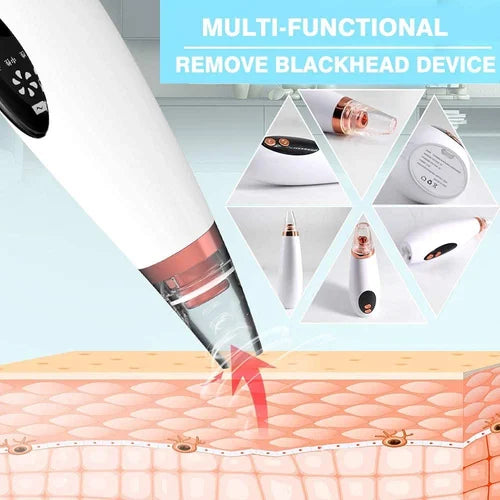 6-in-1 Electric Blackhead Remover & Pore Vacuum Cleaner – Rechargeable Facial Cleansing Device for Clear & Healthy Skin