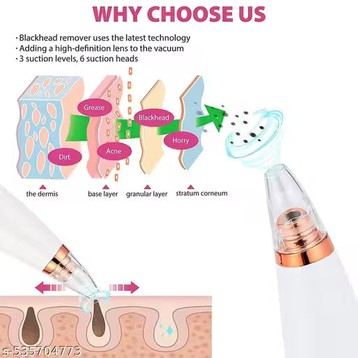 6-in-1 Electric Blackhead Remover & Pore Vacuum Cleaner – Rechargeable Facial Cleansing Device for Clear & Healthy Skin